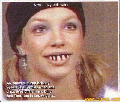 les nouvelles dents de britney spears